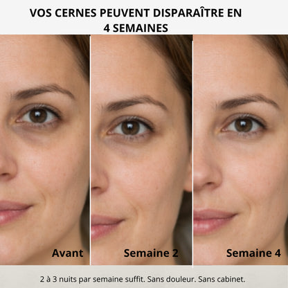 Patch Microaiguilles Contour des Yeux— Anti-Cernes & Ridules