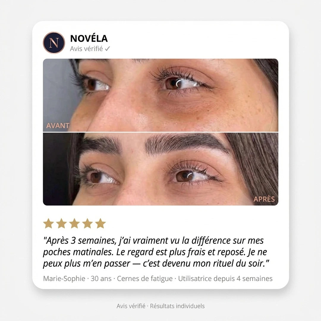 Patch Microaiguilles Contour des Yeux— Anti-Cernes & Ridules
