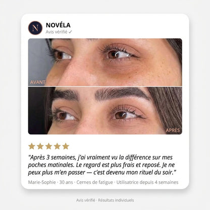 Patch Microaiguilles Contour des Yeux— Anti-Cernes & Ridules